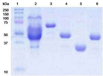 Fig. 61. SDS-PAGE of BGL, CBH, EG, and xylanase purified from P. adiposa.