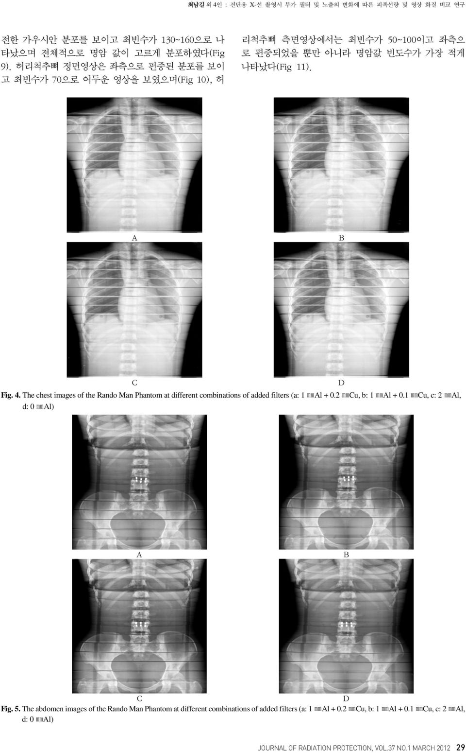4. The chest images of the Rando Man Phantom at different combinations of added filters (a: 1 mml + 0.2 mmcu, b: 1 mml + 0.