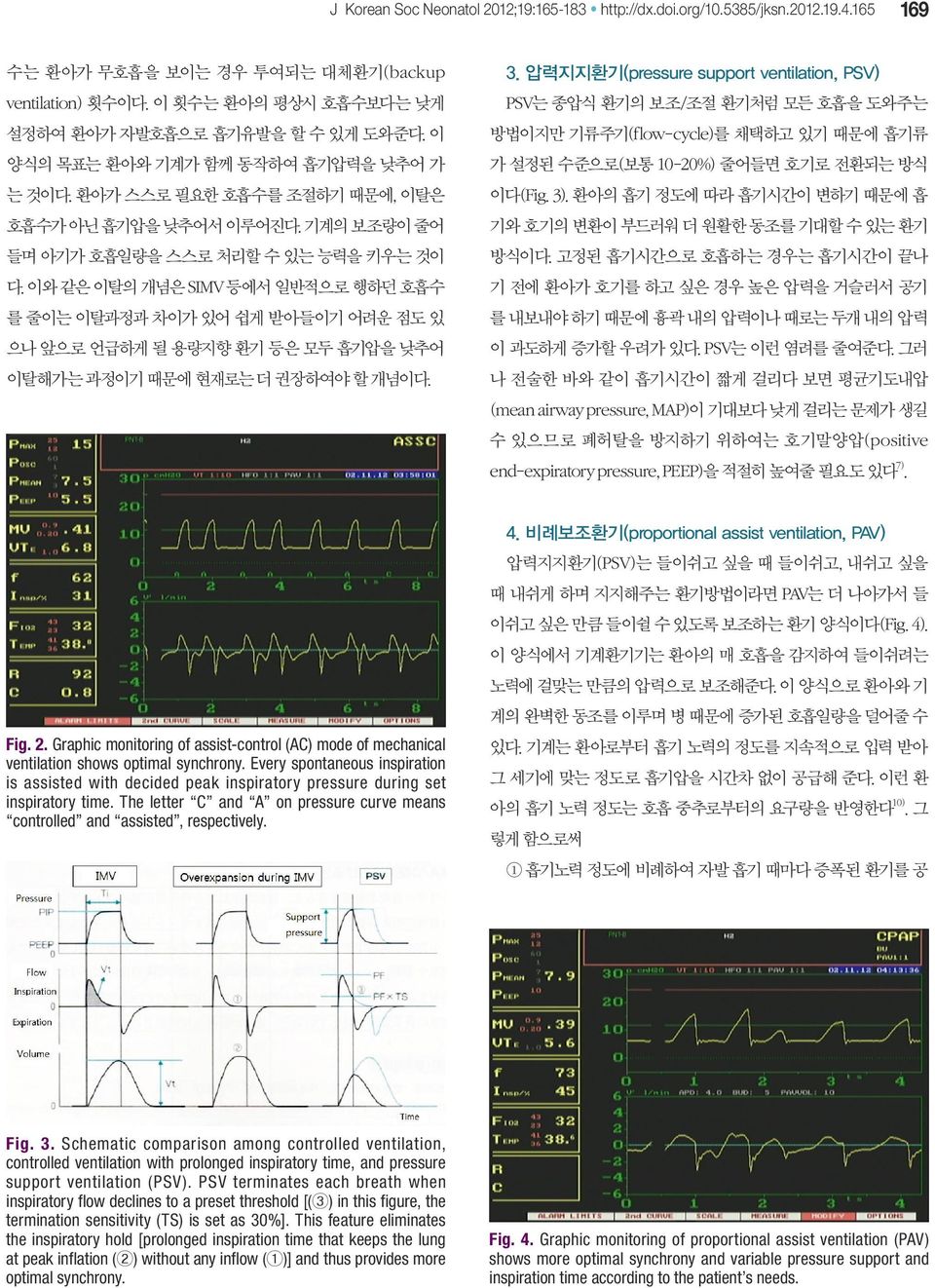 이와 같은 이탈의 개념은 SIMV 등에서 일반적으로 행하던 호흡수 를 줄이는 이탈과정과 차이가 있어 쉽게 받아들이기 어려운 점도 있 으나 앞으로 언급하게 될 용량지향 환기 등은 모두 흡기압을 낮추어 이탈해가는 과정이기 때문에 현재로는 더 권장하여야 할 개념이다. 3.