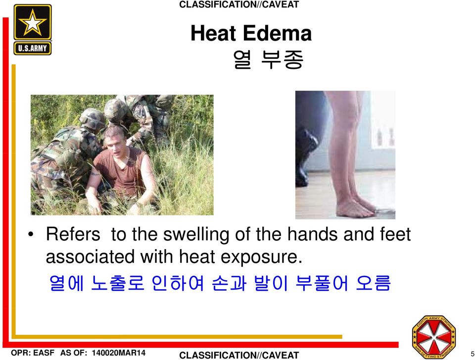 feet associated with heat
