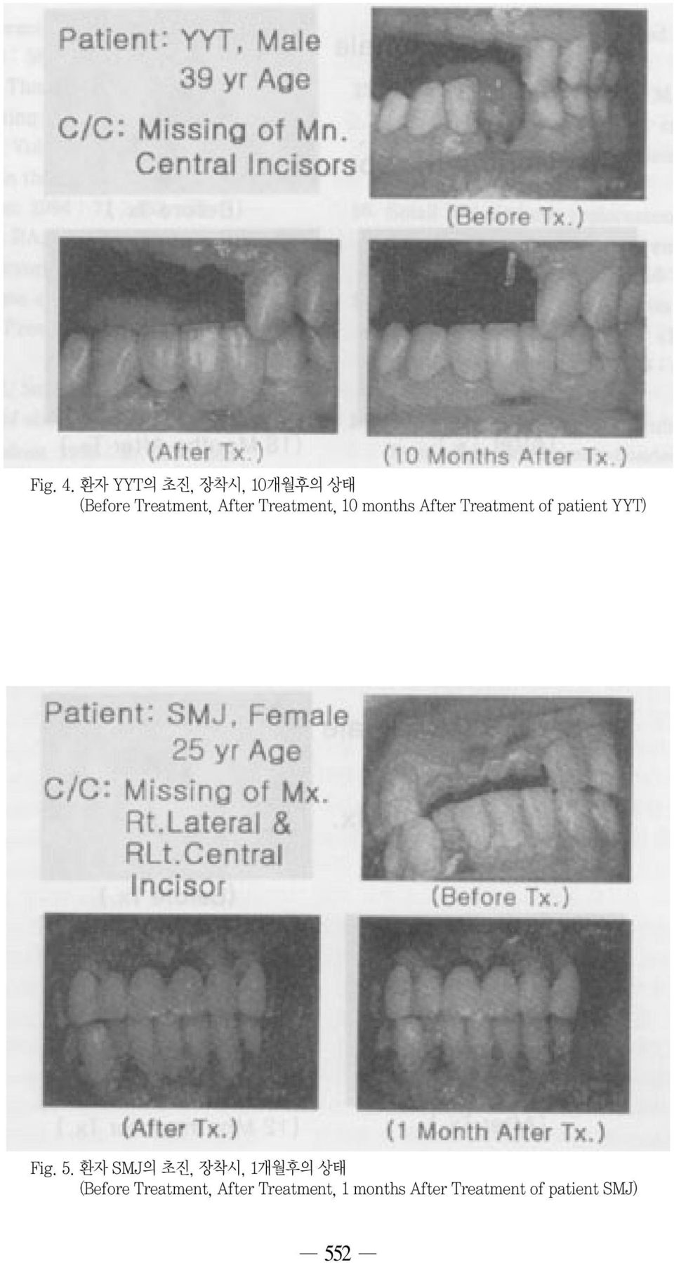 Treatment, 10 months After Treatment of patient YYT) Fig.