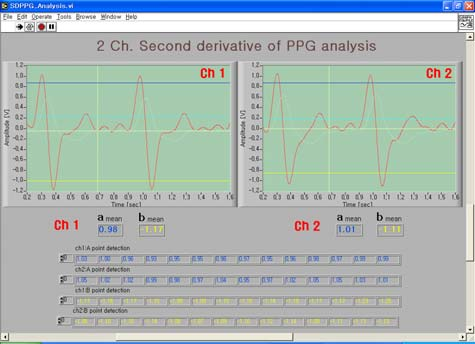 2007 년 7 월전자공학회논문지제 44 권 SC 편제 4 호 17 BF = blood flow T 그림 3. PPG 파형에서의혈류량 Fig. 3. Blood flow in PPG waveform. 그림 2. PPG 센서와혈류량측정장면 Fig. 2. Photo of PPG measurement with its sensors.