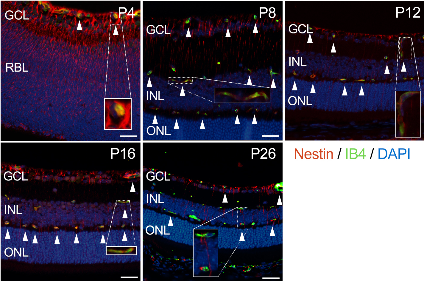 - 대한안과학회지 2016년 제 57 권 제 3 호 - 결 생쥐의 망막혈관 발생 과정에서 네스틴의 발현 생후 4일, 네스틴은 신경절세포층(ganglion cell layer)부 과 정상 생쥐 망막혈관 발생 생후 4일, 시신경유두에서부터 뻗어나가기 시작한 얕은 터 망막모세포층(retinoblast layer)에 걸쳐 강하게 발현되는 혈관 얼기는 중간 주변부