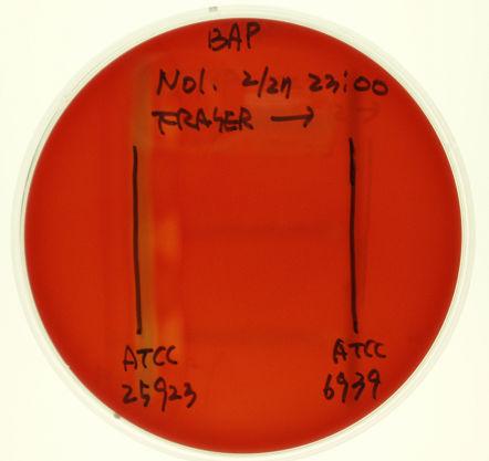 : Rhodococcus equi(atcc 6939) : 음성