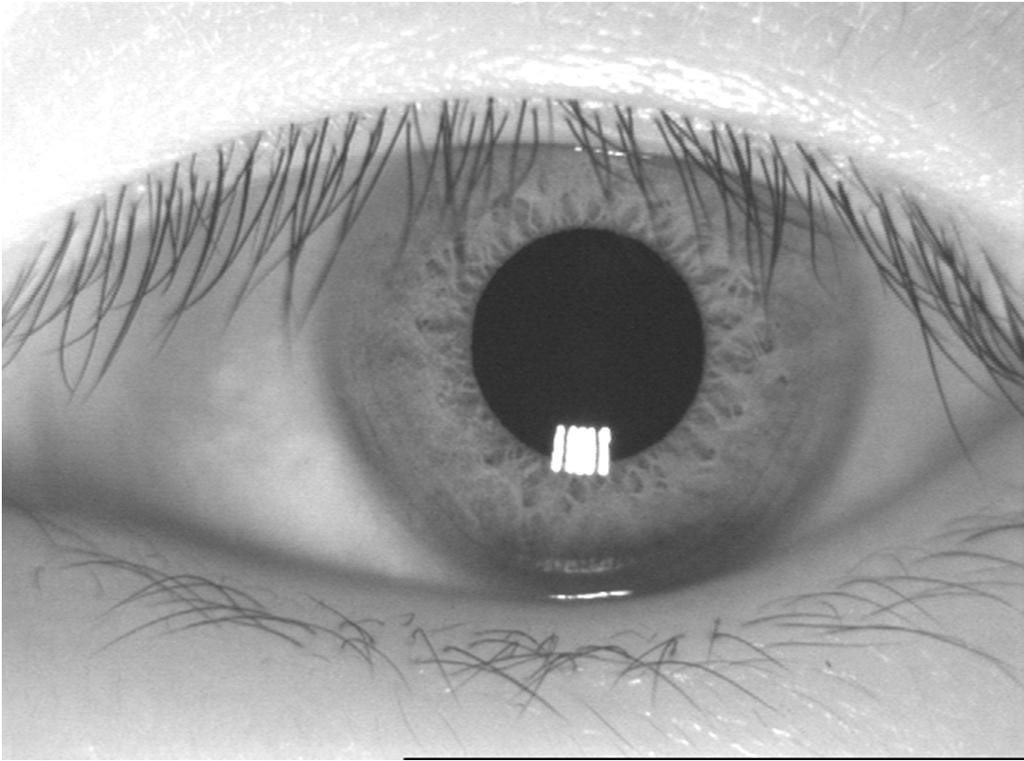 3. 모바일홍채인식 Pupil Iris Sclera - Iris pattern is different for different person.