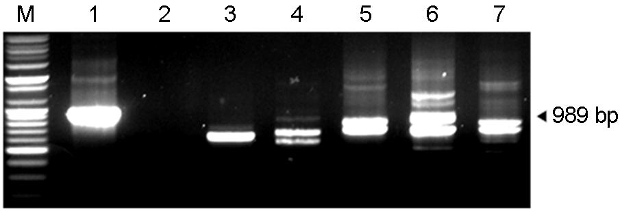 42 HS Lim, et al. Figure 3. DNA fragments obtained by amplification of the 16S-23S rrna intergenic spacer gene of A. baumannii and other bacteria. M: marker, 1: A.