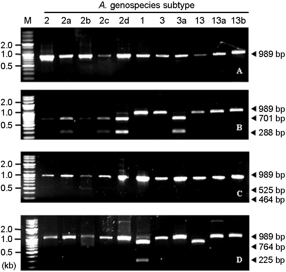 Genospecies Classification of A. calcoaceticus-a. baumannii Complex by RFLP 43 Figure 5. RFLP patterns of the 16S-23S rrna intergenic spacer gene of representative clinical A. calcoaceticus-a. baumannii complex isolates with selected restriction enzymes.
