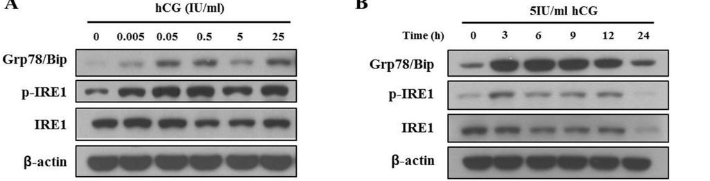 1042 생명과학회지 2014, Vol. 24. No. 10 A B Fig. 1. hcg treatment cause ER stress and leads to IRE1 activation in mltc-1 cells.