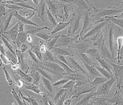 200μM H 2O 2 를처리하였을때많은세포들은심한손상으로인하여배양용기에서떨어져나가세포수가급격히감소하였다. 남아있는세포들은형태가원형으로변하였고세포막에물집을형성하였다. 또한남아있는세포들중일부는세포막의손상으로세포질의농도가희석되어파괴된양상으로관찰되었다 (Fig.
