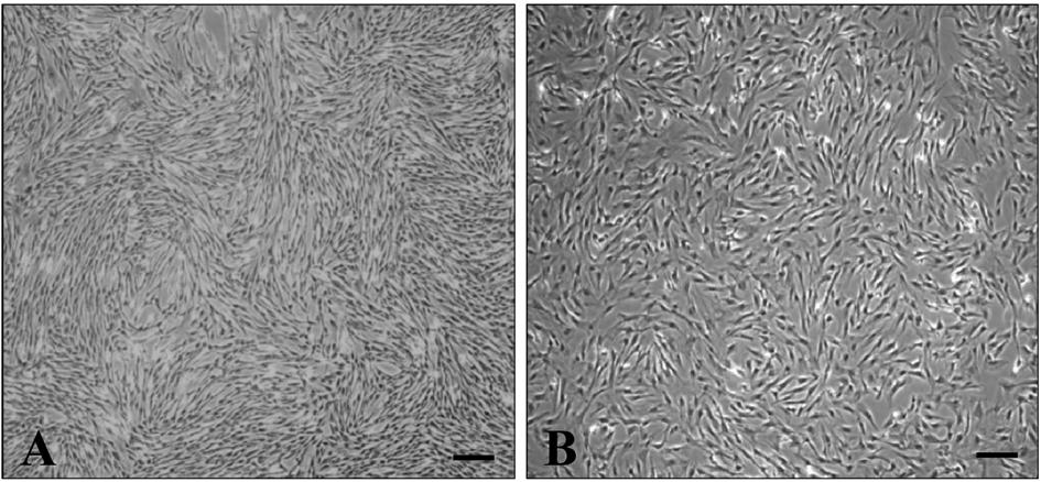 돼지지방조직및골수유래성체줄기세포의성상분석과다능성에관한연구 39 Table 2.