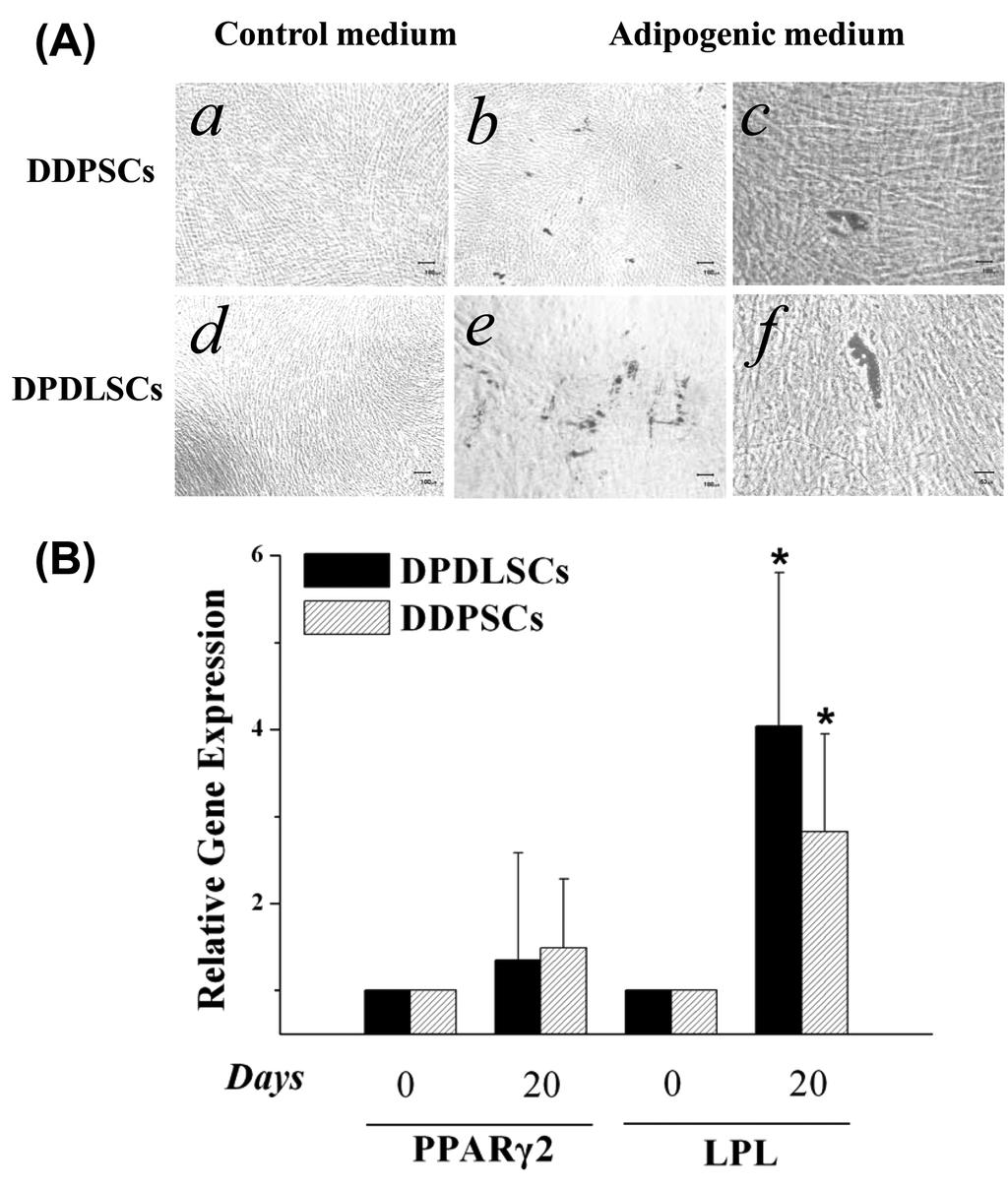 송제선 김승혜 김성오 최병재 김정희 곽성욱 정한성 Figure 5. Adipogenic differentiation of DDPSCs and DPDLSCs.