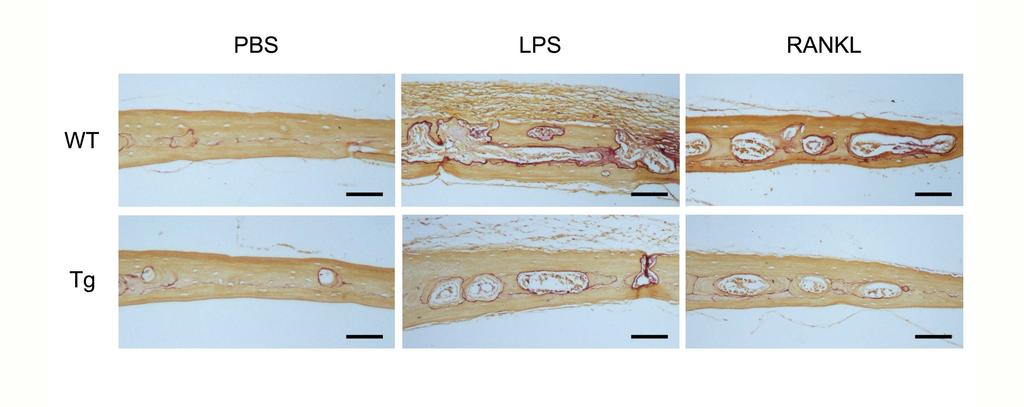 그림 28. Inhibition of LPS- or RANKL-induced osteoclast formation and bone destruction by LC8 overexpression.