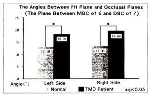 Planes(The Plane Between Midpoint of 1 and MBC of 7) Fig. 10.