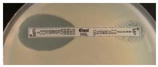 37 C, 2hr sensitivity, specificity