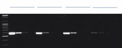 AccuPower ProFi Taq PCR PreMix High Efficiency 및 Long Range PCR 에최적화된 Kit Specifications Enzyme: ProFi Taq DNA polymerase 5 to 3 exonuclease: Yes 3 to 5 exonuclease: Yes 3 - A overhang: Yes PCR
