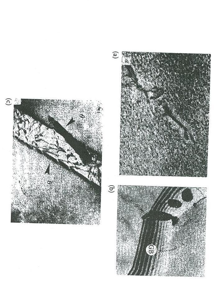 Nucleation sites in Al-Cu alloys Fig. 5.31 Electron micrographs showing nucleation sites in Al-Cu alloys. (a) θ θ.