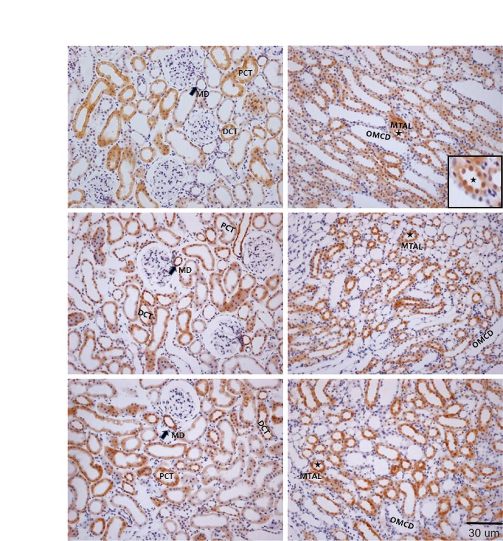 92 배춘상, 조혜정, 안규윤 CTX p-akt OM A D Normal B E LK1W C F LK2W Fig. 3. Images showed the expression of p-akt in Low K + (LK) diet rat kidney.