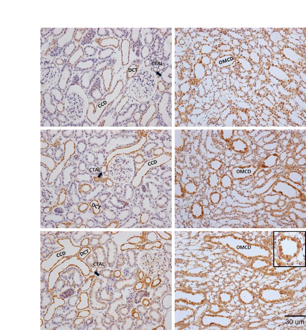저칼륨혈증 Akt, p-akt, ERK 및 p-erk 단백발현 93 CTX ERK OM A D Normal B E LK2W C F LK3W Fig. 4. Images showed the expression of ERK in Low K + (LK) diet rat kidney.