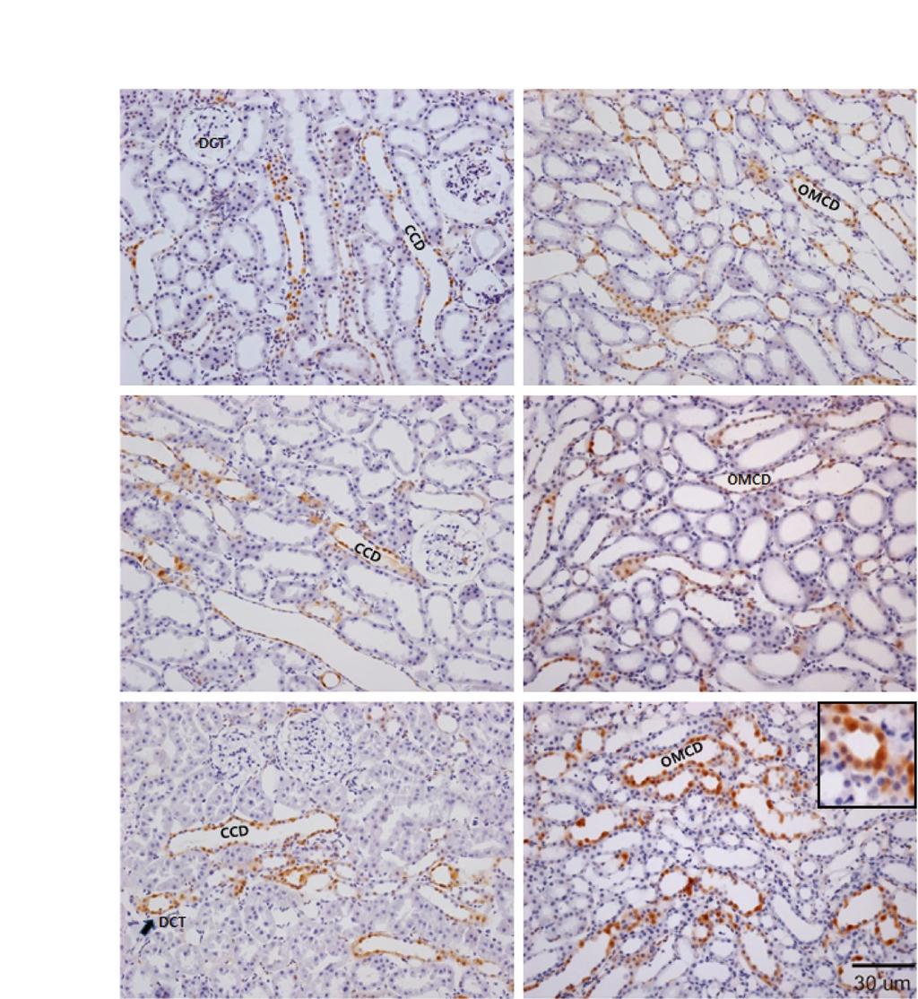 94 배춘상, 조혜정, 안규윤 CTX p-erk OM A D Normal B E LK1W C F LK2W Fig. 5. Images showed the expression of p-erk in Low K + (LK) diet rat kidney.