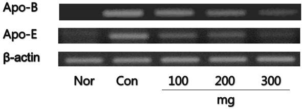 調胃升淸湯추출액이비만유도쥐의지질대사, 항산화계및염증반응계에미치는영향 Fig. 1. RT-PCR analysis for apo-b and apo-e gene expression.