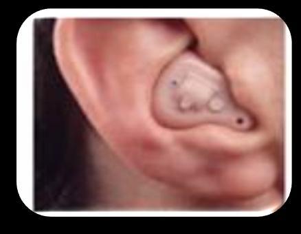 -- Behind the Ear ITE