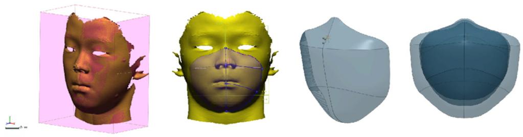 360 김현욱ㆍ서혜경ㆍ명준표ㆍ윤종서ㆍ송윤근ㆍ김충범 Fig 9. Mask design process utilizing the 3D image Fig 10.