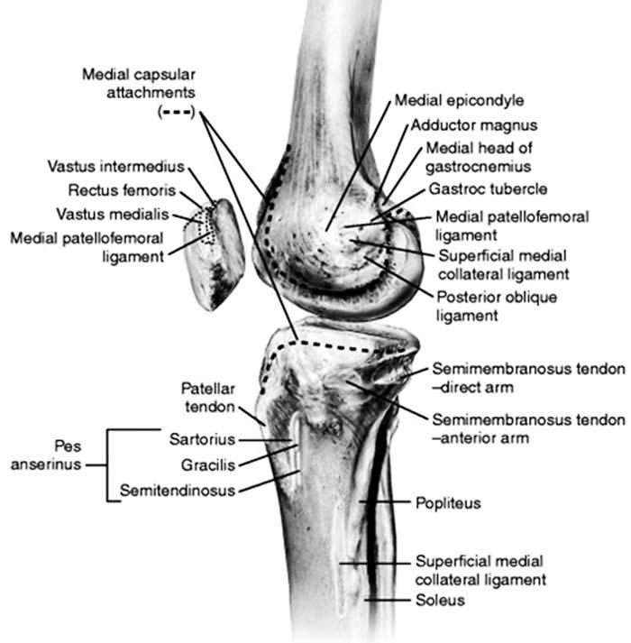 제 2 회관절경수술심포지엄 Medial Patellofemoral Ligament Reconstruction 고려대학교의과대학안산병원정형외과 배지훈 Anatomy of Medial Patellofemoral Ligament Layer 2 (Warren and Marshall) of medial side of the knee Flat, fan-shaped