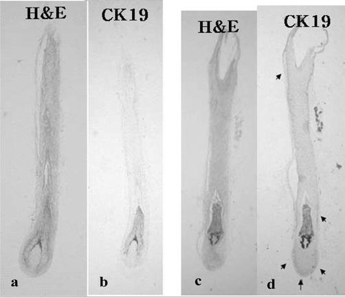 64 o mëo Ëel Ë m Ëp Ë në të r Fig. 9. Histological analysis of organ cultured hair follicles at 10th day (a, b: in Philpott medium; c, d: in DHGM) (Brown color indicates CK19-positive cells).