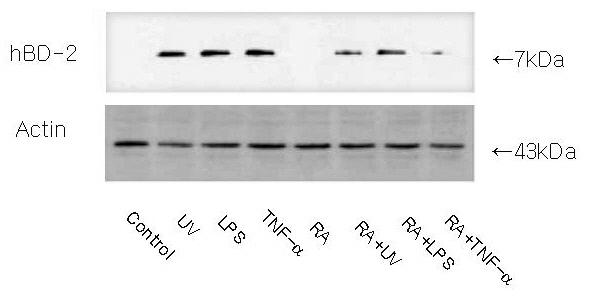 32 대한피부연구학회지 : 제 14 권제 1 호 2007 A B Fig. 2. Western blotting.
