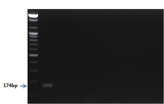 - 유전자분석법활용 - 5. 3. PCR 반응결과 S 1 2 3 4 5 6 7 8 9 그림 82. 복숭아프라이머를이용한 PCR 결과.