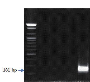 - 유전자분석법활용 - S 1 2 3 4 그림 99. 도라지프라이머를이용한 PCR 결과.