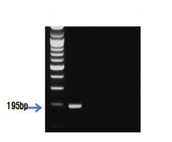 Ⅱ. 종특이프라이머를이용한유전자증폭 PCR 제 2 장 S 1 2 3 그림 118.
