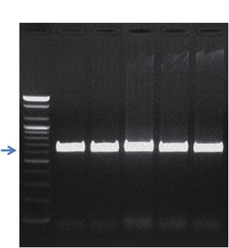 Ⅲ. 일반 universal Ⅱ. 프라이머를이용한유전자증폭 PCR 2. 3. PCR 반응결과 제 3 장 S 1 2 3 4 5 그림 124.