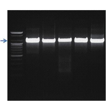 Ⅲ. 일반 universal Ⅱ. 프라이머를이용한유전자증폭 PCR 3. 3. PCR 반응결과 제 3 장 S 1 2 3 4 5 그림 125.