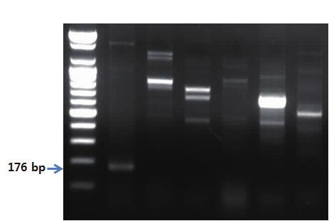 Ⅱ. 종특이프라이머를이용한유전자증폭 PCR 3. 3. PCR 반응결과 제 2 장 S 1 2 3 4 5 6 7 그림 21. 잉어및향어프라이머를이용한 PCR 결과.