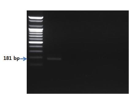 - 유전자분석법활용 - S 1 2 3 4 5 그림 32. 다금바리프라이머를이용한 PCR 결과.