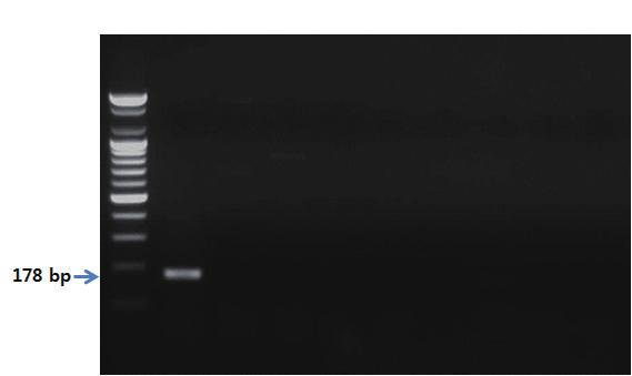 - 유전자분석법활용 - 7. 3. PCR 반응결과 S 1 2 3 4 5 6 7 8 9 그림 52. 기름갈치꼬치프라이머를이용한 PCR 결과.