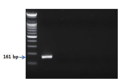 - 유전자분석법활용 - S 1 2 3 4 5 그림 59. 소라프라이머를이용한 PCR 결과.