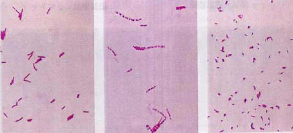 282 Jin-Sk Kim et al. Fig. 1. The detectin f acid fast bacilli in stained smears. N-Acetyl-L-cystine (이하 NALC)를 넣어 객담을 용해시킨 후, 객 담과 동량으로 4% NaOH를 첨가하고 객담이 충분히 풀어지도록 15분간 vrtexing하였다. 혼합액에 멸균된 0.