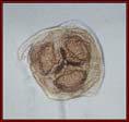 Ascaris lumbricoides - human and
