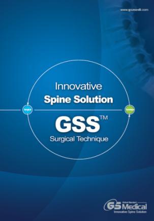 Fixation GSS Pedicle System /