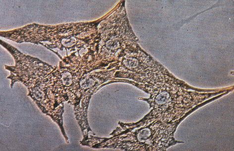 멜라닌형성세포