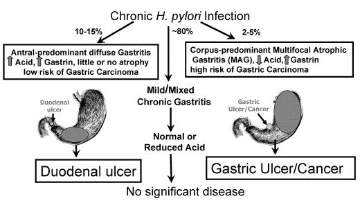 알려진위점막이형성증 (gastric epithelial dysplasia) 은위암으로진행되는 위점막상피에나타나는종양성증식을말한다 (Lauwers, 1999). Figure 1. Results of chronic gastric H. pylori infection.