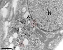 10 Li JJ. Et al, Gold Nanoparticles Induce Oxidative Damage in Lung Fibroblasts In Vitro.