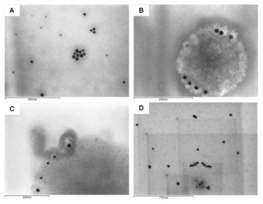 15 Uboldi C. et al. Gold nanoparticles induce cytotoxicity in the alveolar type-ii cell lines A549 and NCIH441. ParticleandFibreToxicology2009, 6:18-21.
