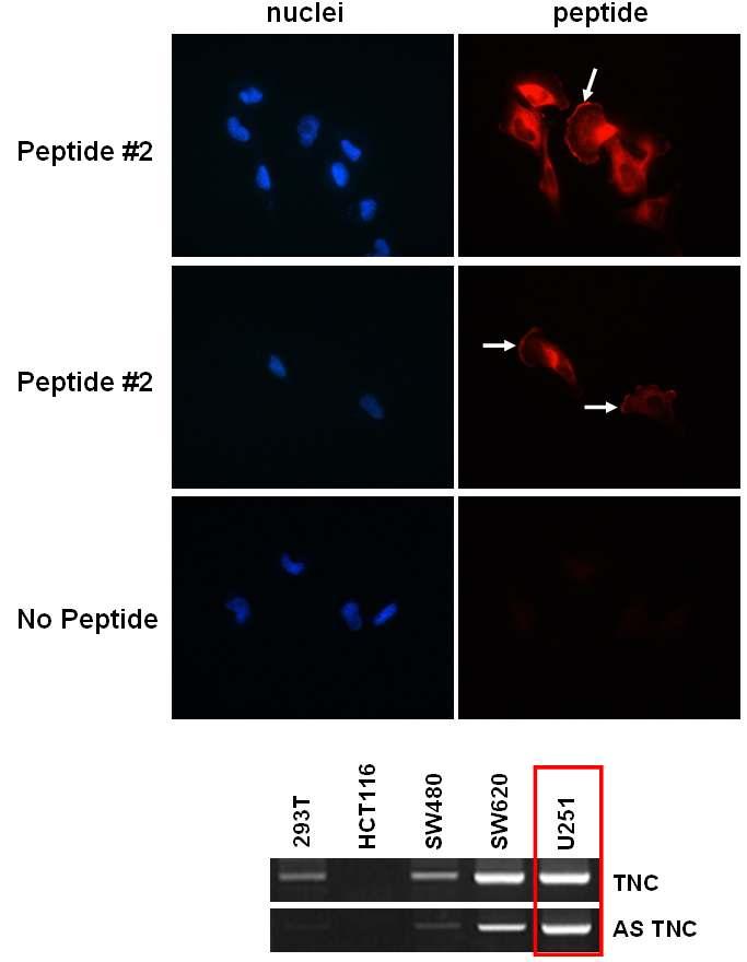 ( 그림 4) Specific detection of U251 cells with the biotin-peptide #2 5. TNC 타겟펩타이드의조직내표적화확인 Tumor 조직의 ECM에위치한 TNC 단백질과 #2 펩타이드의결합을확인하고자 immunohistochemistry 를수행하였음.