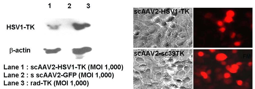 sc39tk 의특성규명을위해 TK 특이적인 western-blotting, immunocytochemistry 을우선확인하였음 ( 그림 13).
