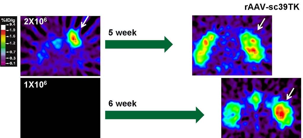 ( 그림 16) M icro-pet imaging in Hela tumor model: TK/18F-FHBG 이러한사실은 raav 에의한유전자발현은어느정도장기적으로유도됨을시 사하는것으로, raav 를이용한종양특이장기적항종양효과를기대할수있음을 지지하고있음. 11.