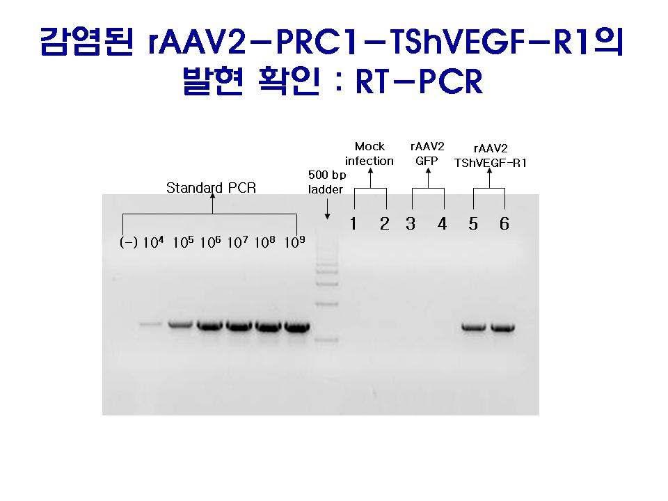 ( 그림 58) In vitro efficacy of raav2-prc1-tshvegf-r1/r2 vectors by suppression of HUVE cell migration 이러한 cell migration 억제효능이 raav2-prc1-tshvegf-r1 와 R2의발현에의한효과인것을증명하기위해동일하게감염처리된시험군들의세포들로부터 total