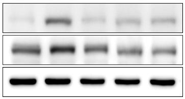 Effect of YG-1 on production of and proteins in LPS-treated rat pineal glands. and protein expression were measured in the each () peak time (6 h) and () last time (12 h) using immunoblot analysis.